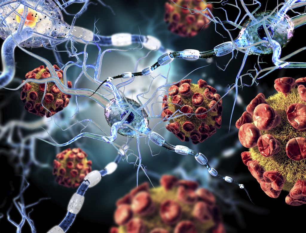 High quality 3d render of viruses attacking nerve cells, concept for Neurologic Diseases, tumors and brain surgery.